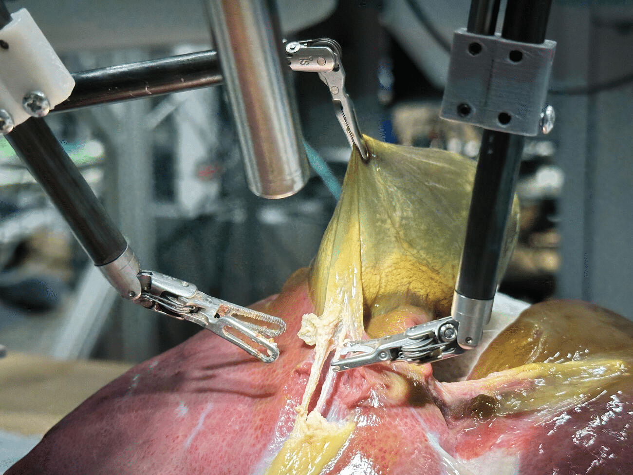 Close-up of robotic surgical instruments clamping a yellowish tissue during a procedure on a raw organ.